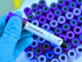 В мире количество больных коронавирусом превысило полмиллиона человек В мире количество больных коронавирусом превысило полмиллиона человек