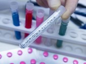 В США количество больных COVID-19 уже перевалило за миллион человек