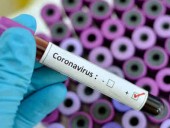 В России начали лечить больных COVID-19 плазмой крови излеченных лиц