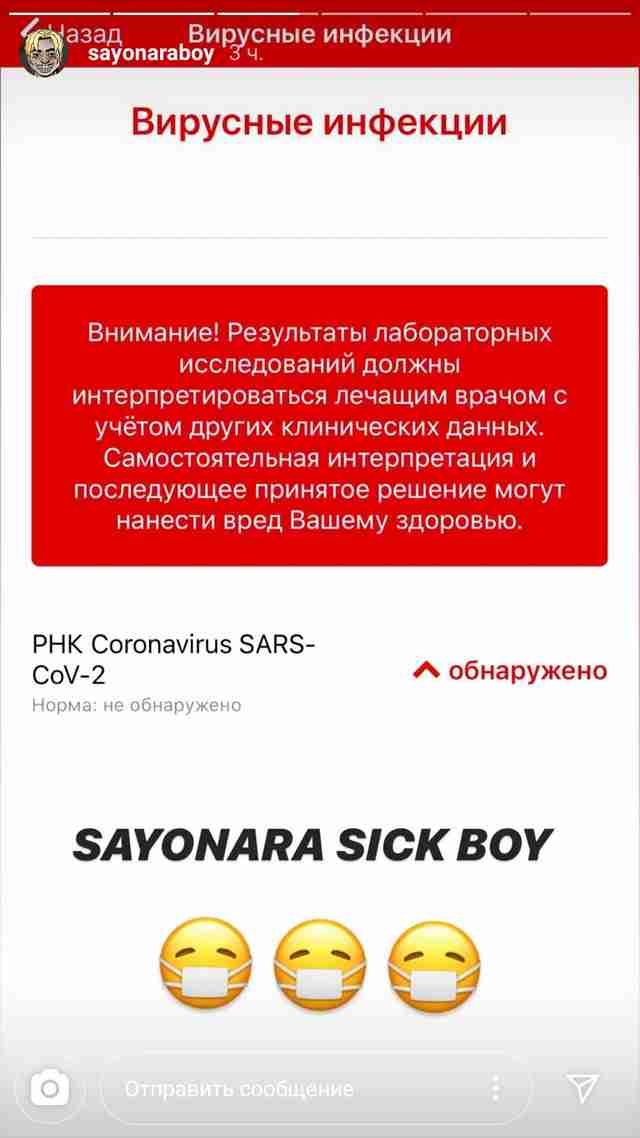 У российского рэпера Елджея и его жены Ивлеевой обнаружили коронавирус У российского рэпера Елджея и его жены Ивлеевой обнаружили коронавирус