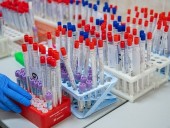 В Татарстане огласили результаты первого этапа ИФА-скрининга и начали второй В Татарстане огласили результаты первого этапа ИФА-скрининга и начали второй