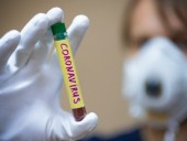В Тбилиси два дня будут проводить бесплатные тесты на COVID-19