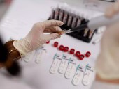 Во Франции одобрены тесты на антиген коронавируса в качестве альтернативы ПЦР Во Франции одобрены тесты на антиген коронавируса в качестве альтернативы ПЦР