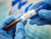Пандемия: в мире COVID-19 заболели более 53 млн человек Пандемия: в мире COVID-19 заболели более 53 млн человек