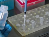 Пандемия: новую разновидность COVID-19 в Великобритании обнаружили еще в сентябре Пандемия: новую разновидность COVID-19 в Великобритании обнаружили еще в сентябре