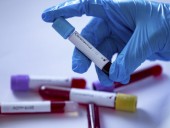 Коронавирусной инфекцие в мире заболело уже более 124, 6 млн человек Коронавирусной инфекцие в мире заболело уже более 124, 6 млн человек