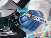 В Швейцарии обнаружили первый случай индийского штамма COVID-19 В Швейцарии обнаружили первый случай индийского штамма COVID-19