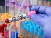 В Грузии выявили первые случаи заражения штаммом Omicron В Грузии выявили первые случаи заражения штаммом Omicron